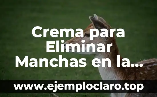 ¿Quién es Conchita, la ganadora de Tu Cara Me Suena? 4 Crema para Eliminar Manchas en la Cara: Descubre la Solución Ideal para una Piel Libre de Imperfecciones