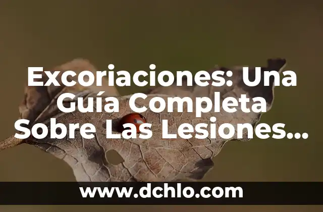 Cómo quitar el contestador de Yoigo: Guía definitiva 5 Excoriaciones: Una Guía Completa Sobre Las Lesiones Cutáneas