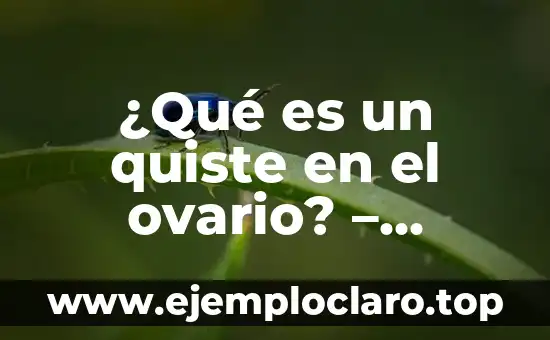 ¿Qué es un quiste en el ovario? - Definición, causas, síntomas y tratamientos