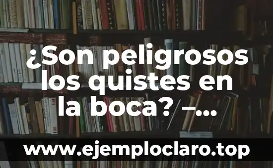 Teoría de la Información Significado 5 ¿Son peligrosos los quistes en la boca? – Información y consejos médicos